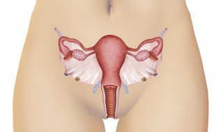 得盆腔炎的原因 为什么得盆腔炎