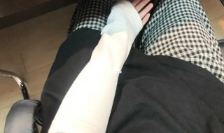 冰袖的危害有哪些 冰袖的危害