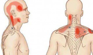 斜方肌形成的原因 斜方肌是怎么造成的