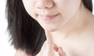 如何去除痘痘留下的黑印 痘痘留下的黑印怎么去