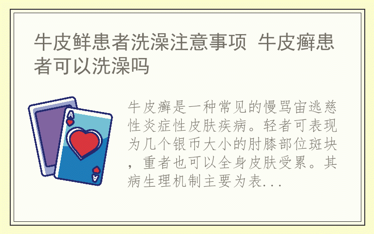 牛皮鲜患者洗澡注意事项 牛皮癣患者可以洗澡吗