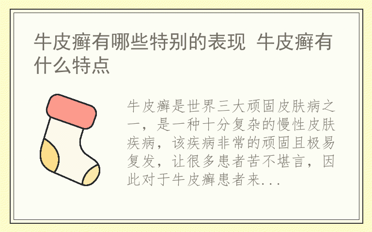 牛皮癣有哪些特别的表现 牛皮癣有什么特点