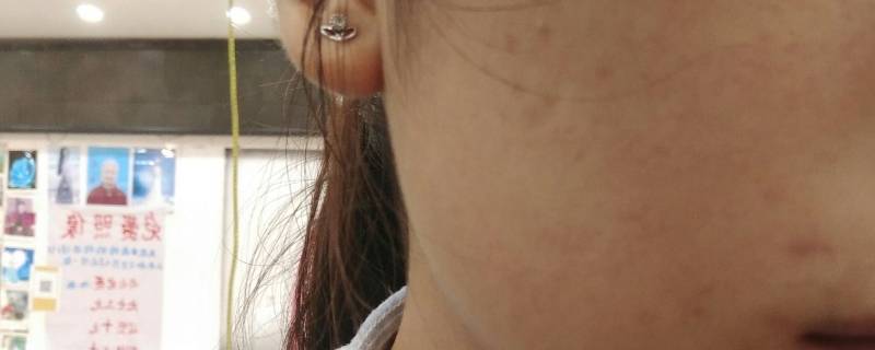 可能是脸上皮肤发黑的原因有哪些 脸上皮肤变黑是什么原因