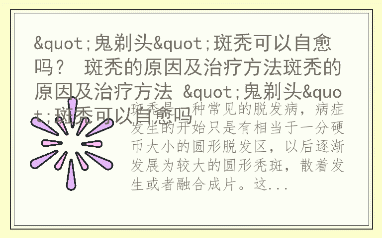 "鬼剃头"斑秃可以自愈吗？ 斑秃的原因及治疗方法斑秃的原因及治疗方法 "鬼剃头"斑秃可以自愈吗