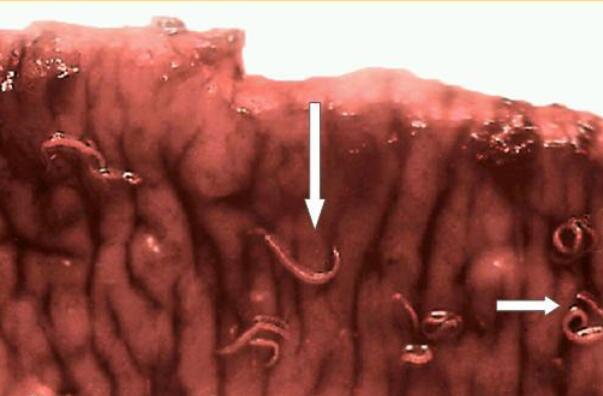 钩虫上榜(严重危害人民健康)-世界十大可怕寄生虫
